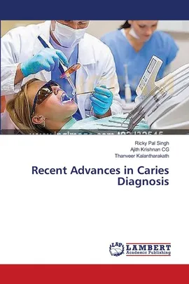 Recent Advances in Caries Diagnosis - Ricky Pal Singh