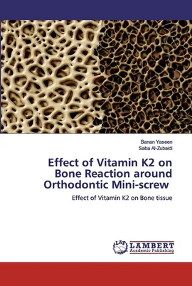 Effect of Vitamin K2 on Bone Reaction around Orthodontic Mini-screw - Banan Yaseen