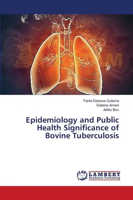 Epidemiology and Public Health Significance of Bovine Tuberculosis - Gutema Fanta Desissa