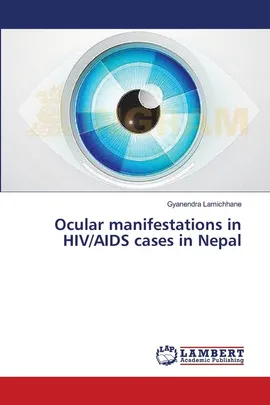 Ocular manifestations in HIV/AIDS cases in Nepal - Gyanendra Lamichhane