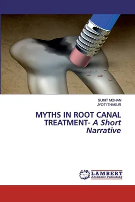 Myths in Root Canal Treatment - A Short Narrative - Sumit Mohan