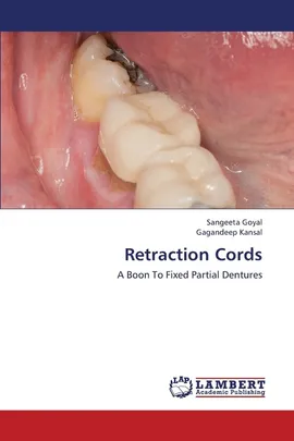 Retraction Cords - Sangeeta Goyal