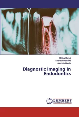 Diagnostic Imaging In Endodontics - Kritika Katyal