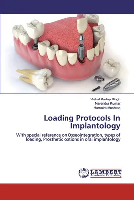 Loading Protocols In Implantology - Vishal Partap Singh