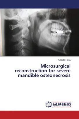 Microsurgical reconstruction for severe mandible osteonecrosis - Ricardo Horta