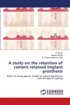 A study on the retention of cement retained implant prosthesis - R. Surya
