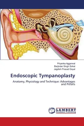 Endoscopic Tympanoplasty - Priyanka Aggarwal
