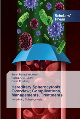 Hereditary Spherocytosis - Youness Eman Refaat