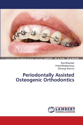 Periodontally Assisted Osteogenic Orthodontics - Ravi Bhandari
