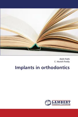 Implants in orthodontics - Akshi Rathi