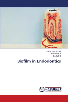 Biofilm in Endodontics - Steffin Elsa Money