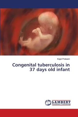 Congenital tuberculosis in 37 days old infant - Kajal Prakash