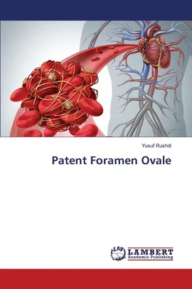 Patent Foramen Ovale - Yusuf Rushdi