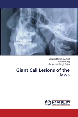 Giant Cell Lesions of the Jaws - Jaspreet Singh Badwal