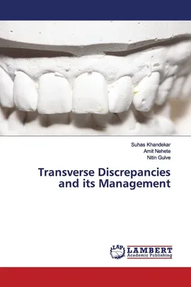 Transverse Discrepancies and its Management - Suhas Khandekar