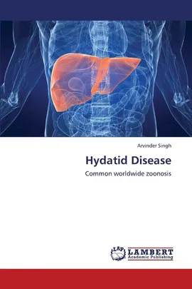 Hydatid Disease - Arvinder Singh