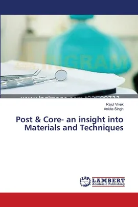 Post & Core- an insight into Materials and Techniques - Rajul Vivek
