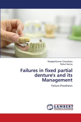 Failures in fixed partial denture's and its Management - Ranjeet Kumar Chaudhary