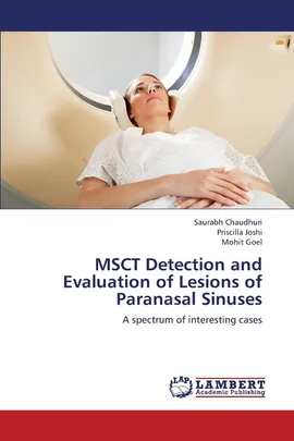 Msct Detection and Evaluation of Lesions of Paranasal Sinuses - Saurabh Chaudhuri