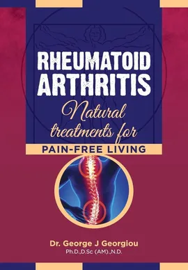 Rheumatoid Arthritis - George John Georgiou