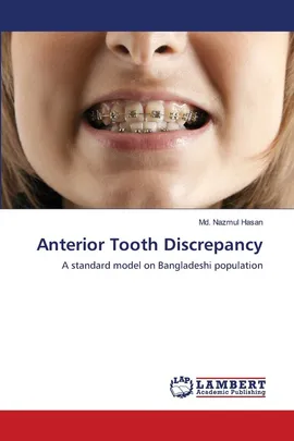Anterior Tooth Discrepancy - Md. Nazmul Hasan