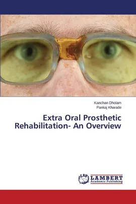 Extra Oral Prosthetic Rehabilitation- An Overview - Kanchan Dholam