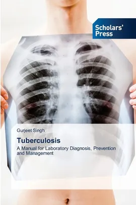 Tuberculosis - Gurjeet Singh