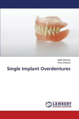 Single Implant Overdentures - Mohit Dhawan