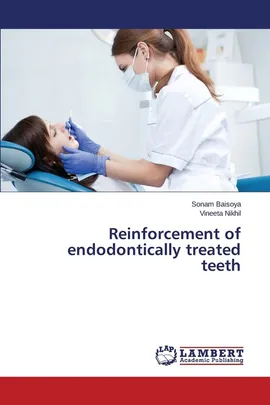 Reinforcement of endodontically treated teeth - Sonam Baisoya