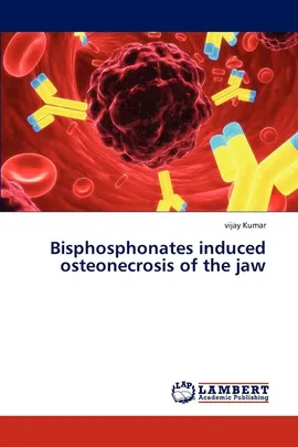 Bisphosphonates induced osteonecrosis of the jaw - Vijay Kumar