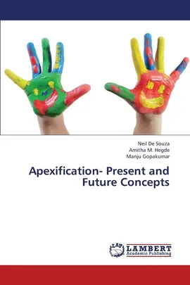 Apexification- Present and Future Concepts - Souza Neil De
