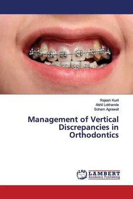 Management of Vertical Discrepancies in Orthodontics - Rajesh Kuril