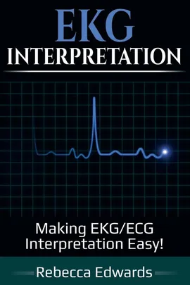 EKG Interpretation - Rebecca Edwards