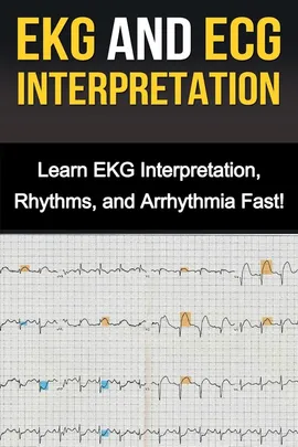 EKG and ECG Interpretation - Alyssa Stone