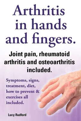 Arthritis in Hands and Arthritis in Fingers. Rheumatoid Arthritis and Osteoarthritis Included. Symptoms, Signs, Treatment, Diet, How to Prevent & Exer - Lucy Rudford
