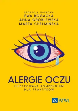 Alergie oczu. Ilustrowane kompendium dla praktyków - Ewa Bogacka, Anna Groblewska, Marta Chełmińska