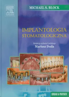 Implantologia stomatologiczna - Block Michael S.