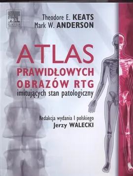 Atlas prawidłowych  obrazów RTG imitujących stan patologiczny - Mark Anderson, Keats Theodore Walecki Jerzy