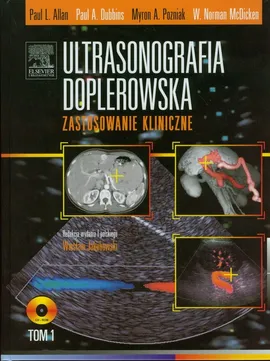 Ultrasonografia doplerowska Zastosowanie kliniczne Tom 1 z płytą DVD - Allan Paul L., Dubbins Paul A., McDicken W. Norman, Pozniak Myron A.