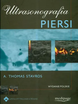 Ultrasonografia piersi - Outlet - Stavros Thomas A.