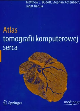 Atlas tomografii komputerowej serca - Stephan Achenbach, Budoff Matthew J., Jagat Narula