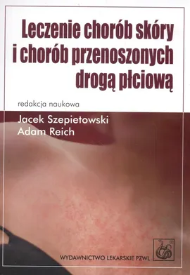 Leczenie chorób skóry i chorób przenoszonych drogą płciową - Outlet - Adam Reich, Jacek Szepietowski