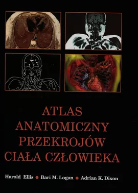 Atlas anatomiczny przekrojów ciała człowieka - Dixon Adrian K., Harold Ellis, Logan Bari M.