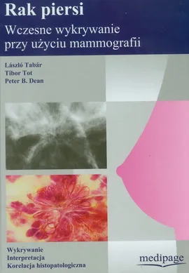 Rak piersi wczesne wykrywanie przy użyciu mammografii - Outlet - Dean Peter B., Laszlo Tabar, Tibor Tot
