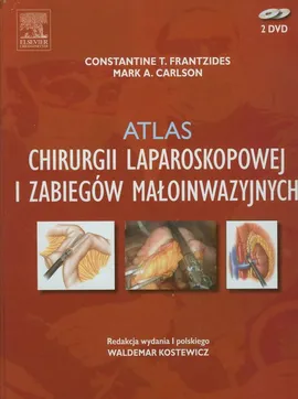 Atlas chirurgii laparoskopowej i zabiegów małoinwazyjnych - Carlson Mark A., Frantzides Constantine T.
