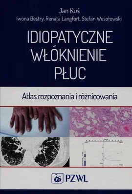 Idiopatyczne włóknienie płuc - Iwona Bestry, Jan Kuś, Renata Langfort