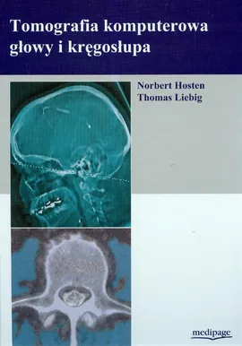Tomografia komputerowa głowy i kręgosłupa - Norbert Hosten, Thomas Liebig