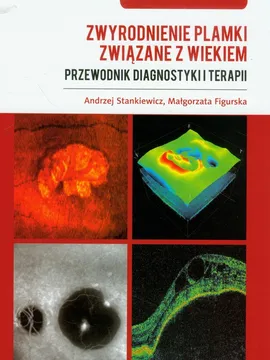 Zwyrodnienie plamki związane z wiekiem Przewodnik diagnostyki i terapii - Małgorzata Figurska, Andrzej Stankiewicz