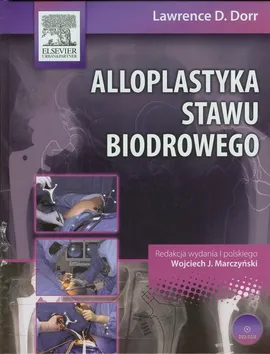 Alloplastyka stawu biodrowego z płytą DVD - Dorr Lawrence D.