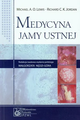 Medycyna jamy ustnej - Outlet - Jordan Richard C.K., Lewis Michael A.O.